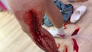 В екатеринбургском районе Академический произошло нападение с ножом на молодого человека