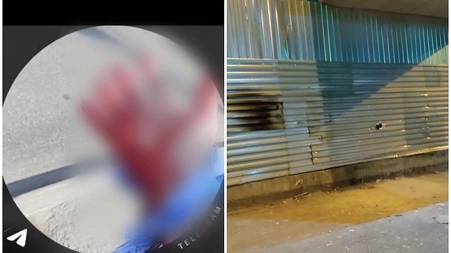 Подросток едва не лишился руки на легендарном недострое Екатеринбурга: охрана проигнорировала мольбу о помощи