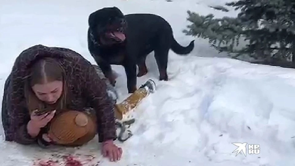 Мать, защищавшая сына от ротвейлера, требует 735 тысяч рублей с хозяев собаки