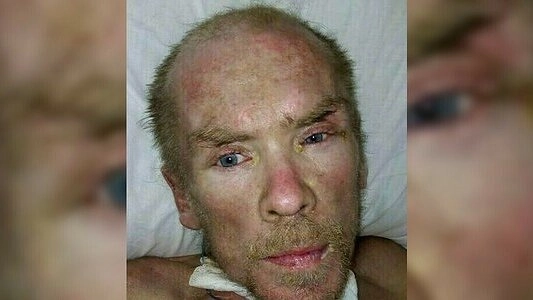 Помогите опознать: в больнице Екатеринбурга лежит неизвестный с возможной амнезией