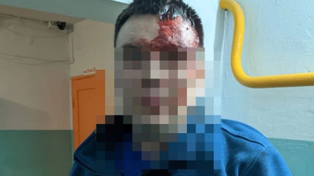 Главная картинка новости: В Свердловской неадекватный напал на фельдшера скорой и разбил ему голову