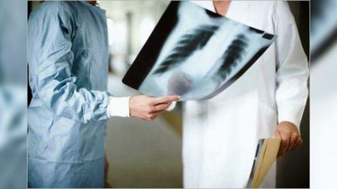 Главная картинка новости: Минздрав: пациенты с 20% поражением легких от COVID могут лечиться дома