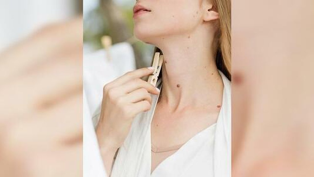 Главная картинка новости: Онкодерматологи Екатеринбурга приглашают всех бесплатно проверить родинки