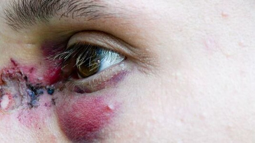 Главная картинка новости: В Екатеринбурге бизнесмен на «Лексусе» расстрелял из пейнтбольного маркера двух молодых людей во дворе дома на улице Советской – 10 августа 2016 года фото