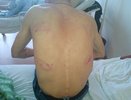 В Камышлове два безработных друга сломали ребра инвалиду