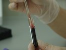 Екатеринбург подписал Парижскую декларацию по борьбе с ВИЧ