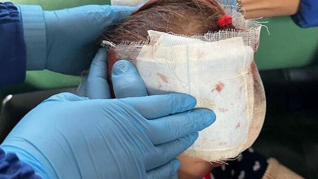 Главная картинка новости: Требует с садика полтора миллиона: жительница Екатеринбурга настаивает на выплате из-за травмы дочери