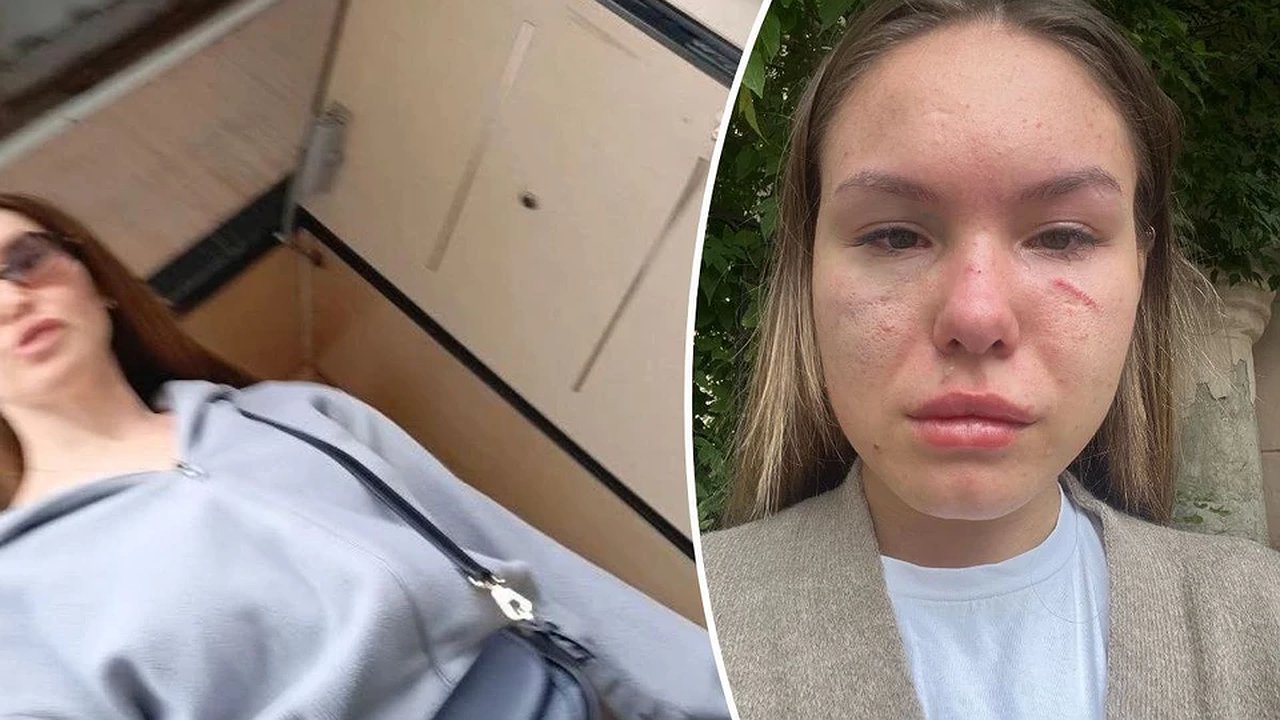 Главная картинка новости: Конфликт в управлении образования Екатеринбурга: молодая мама получила сотрясение мозга в очереди за детский сад