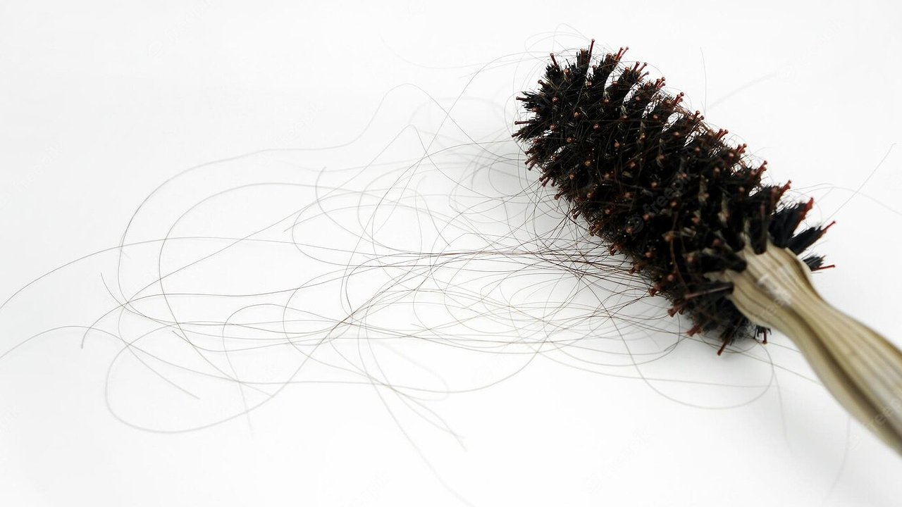 Главная картинка новости: Врач назвал главную зимнюю ошибку, из-за которой редеют волосы