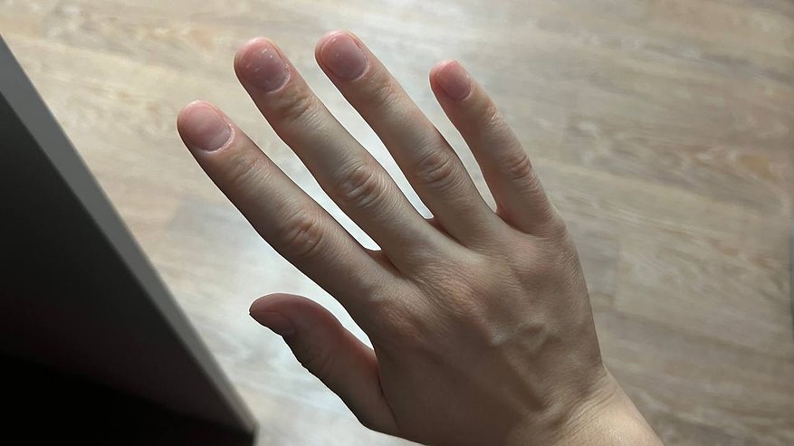 Главная картинка новости: Врач посмотрел на мои ногти и сразу сказал, чего не хватает организму. Проверила — всё сошлось