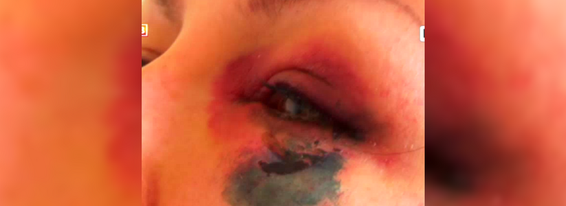 В Перовоуральске в ночном клубе «Биг Бен Паб» избили женщину - фото 12 сентября 2015 года