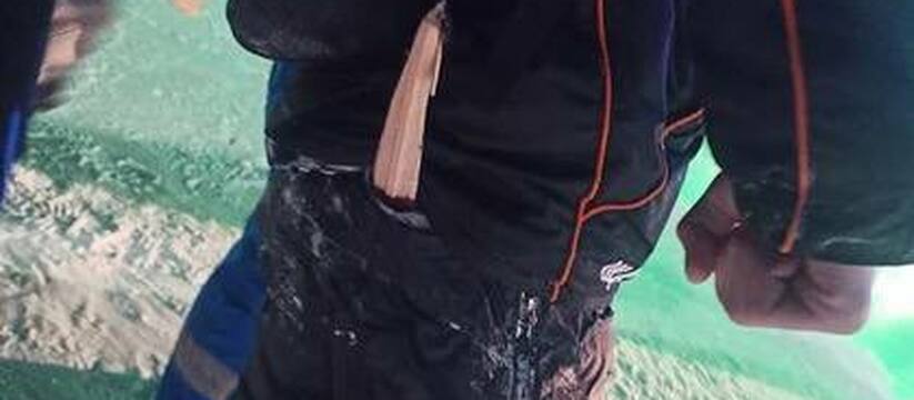 Разорвало ногу: юный житель Урала напоролся на щепу во время катания с горки 